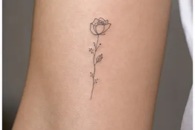 Tattoo Removal